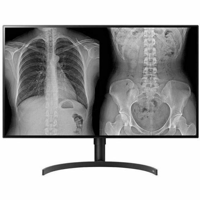 LG 32HL512D-B 32" Class 4K UHD LCD Monitor - 16:9 - Black - TAA Compliant